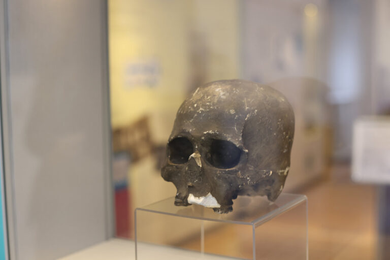 Model skull at The Infirmary Museum 768x512